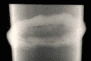 Рентгенография сварных швов